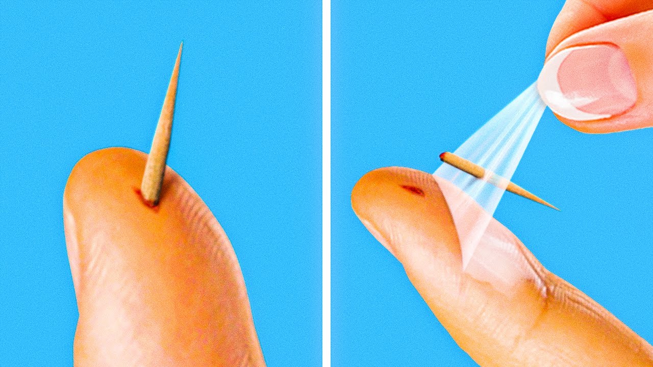 30 EASY HOME REMEDIES FOR COMMON TROUBLES