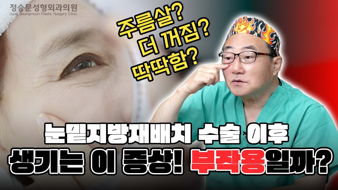 눈밑지방재배치 수술 후 생긴 이 증상! 과연 부작용일까?