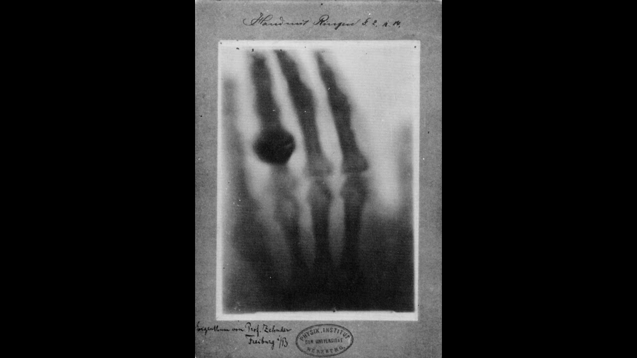 [Storia della medicina #4] Dal primo vaccino ai giorni nostri