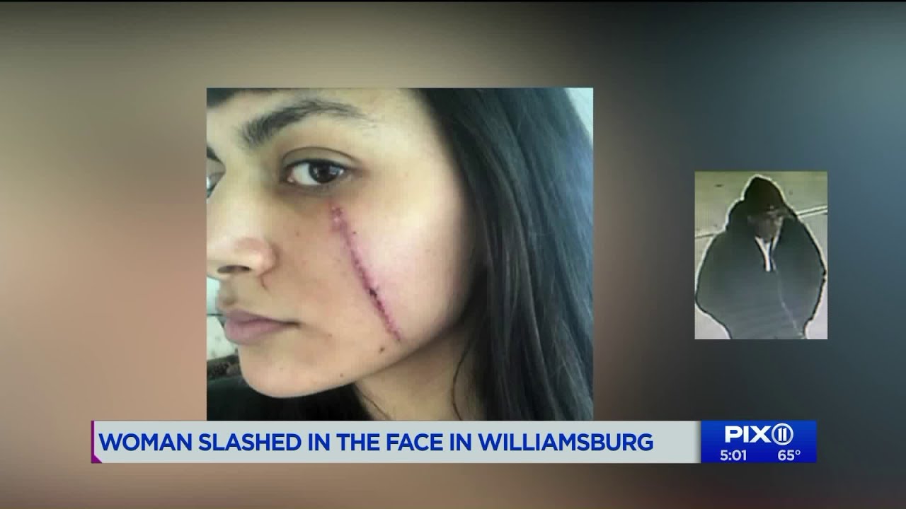 Woman slashed in the face in Williamsburg