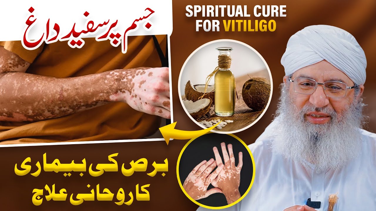 Bars Ka Rohani Ilaj | Jism Ke Daag Dahbe door Karne Ka Ilaj | Haji Shahid Attari