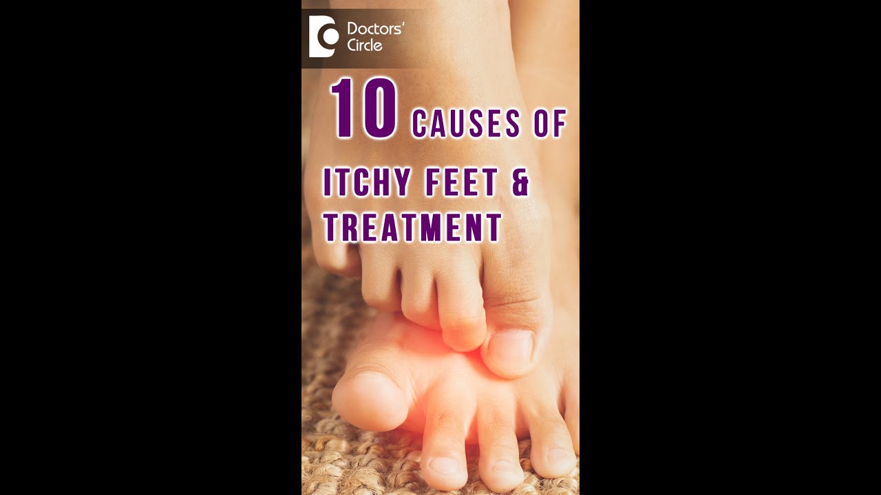 10 Causes of ITCHY FEET & how to get relief? - Dr. Urmila Nischal |Doctors' Circle #shorts