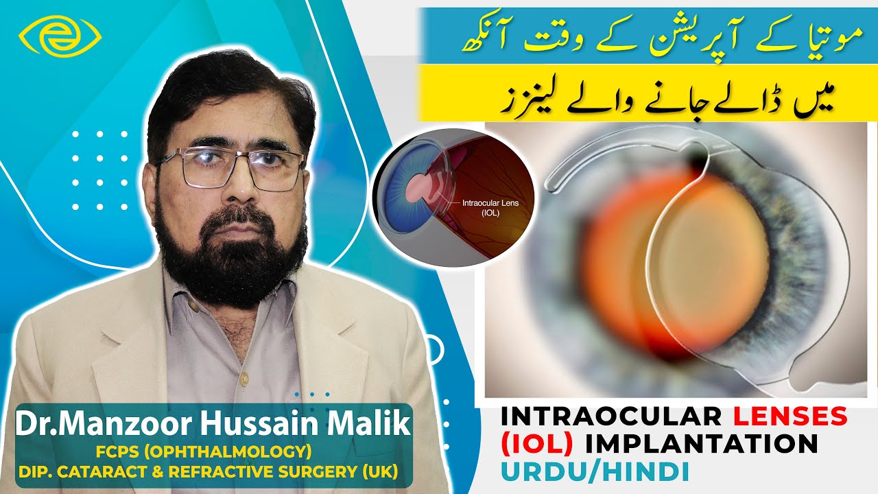 Intraocular Lenses (IOL)  Implantation | Urdu/Hindi