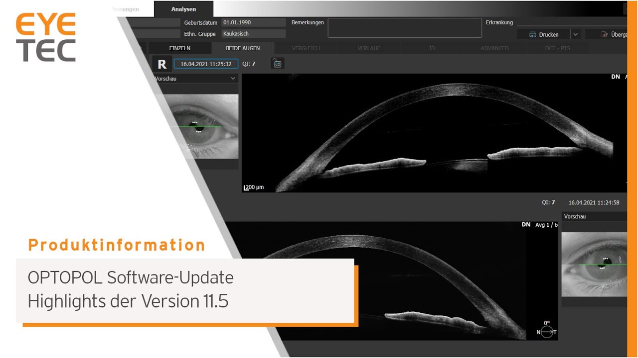 Optopol REVO OCT Software Update V11.5