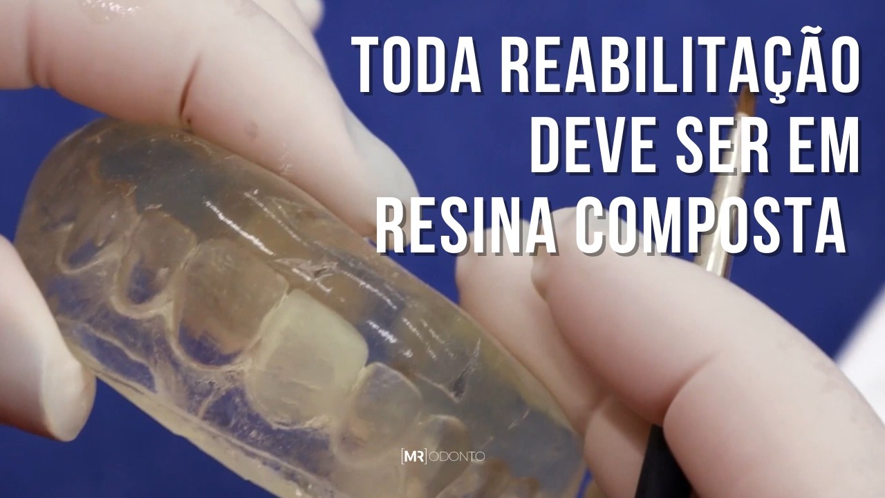 TODA REABILITAÇÃO DEVE SER FEITA COM RESINA COMPOSTA, PONTO!