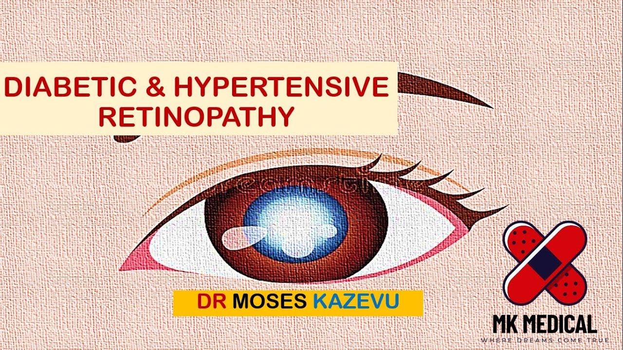 Diabetic & Hypertensive retinopathy