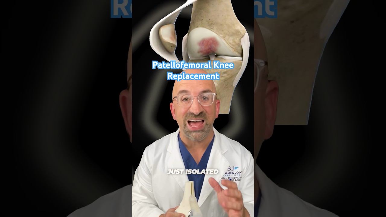 Forever Fix for Severe Anterior Knee Pain #shorts