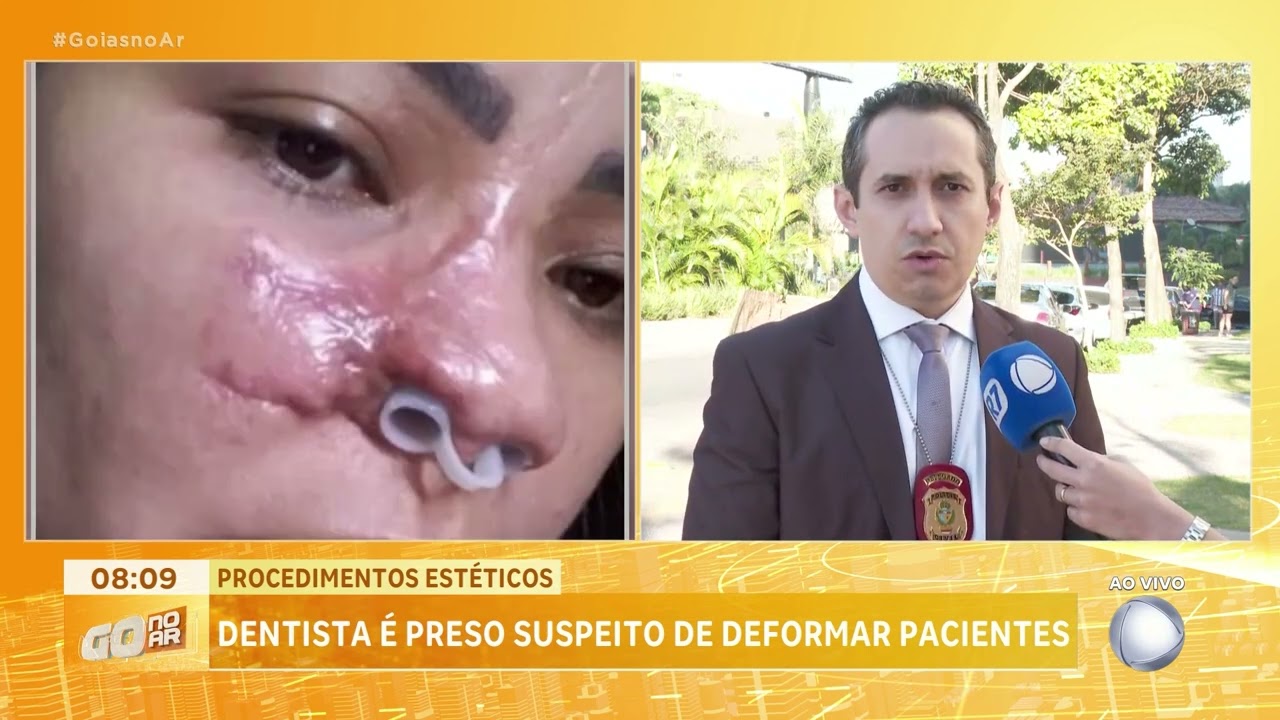PROCEDIMENTOS ESTÉTICOS: DENTISTA É PRESO SUSPEITO DE DEFORMAR PACIENTES