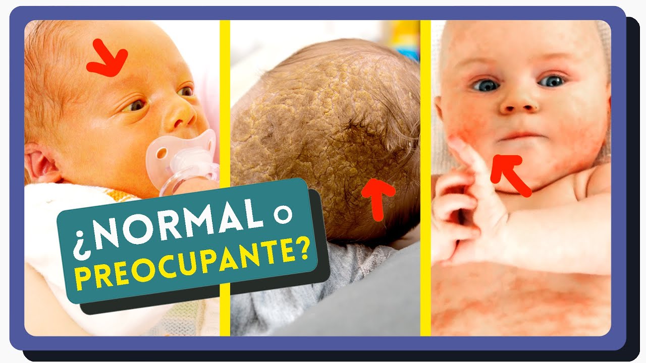 TODO lo que debes saber de la PIEL del BEBÉ: Ictericia, Protección solar, Recién nacidos, Atopia...