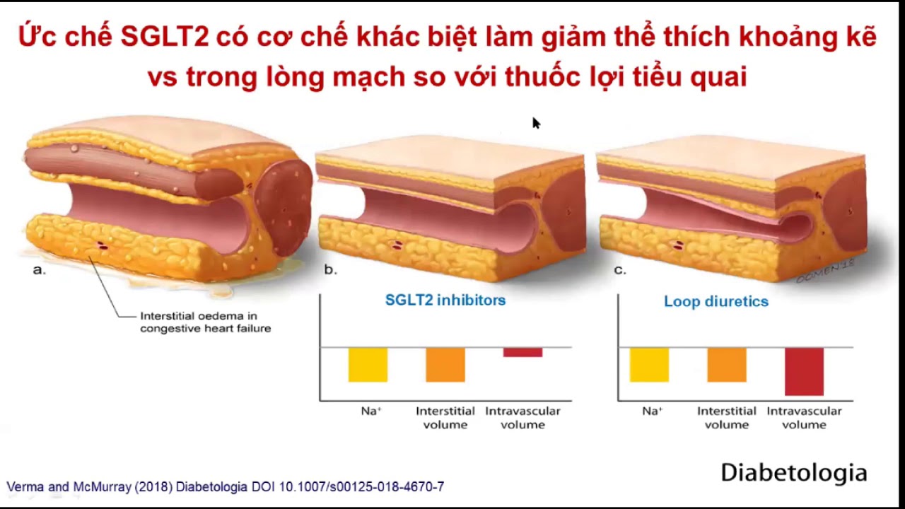 Chiến lược điều trị bệnh thận mạn ở bệnh nhân đái tháo đường: quá khứ - hiện tại và tương lai
