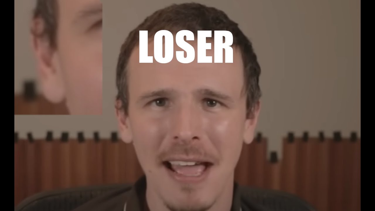 idubbbz is a WHINY LOSER and BALD