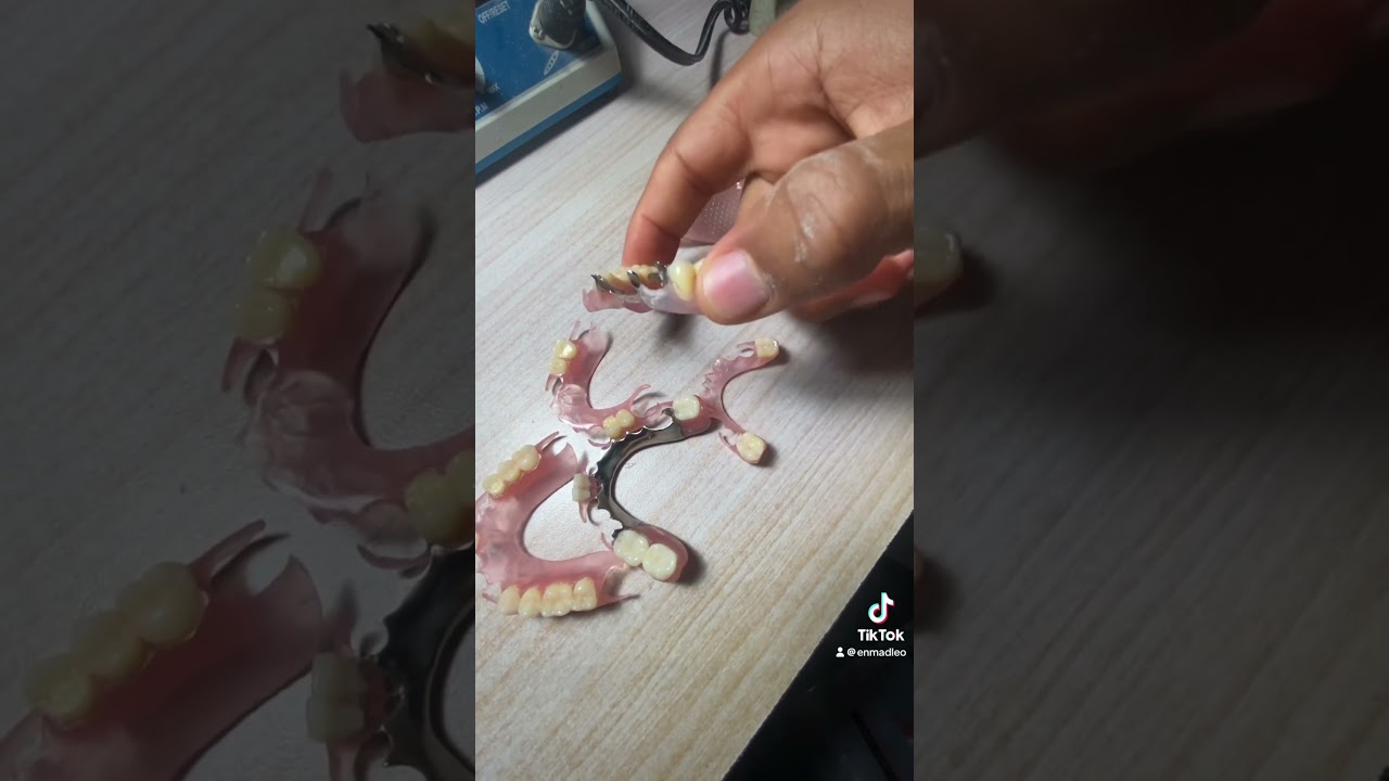 LAS MEJORES PR&Oacute;TESIS DENTALES REMOVIBLES.
