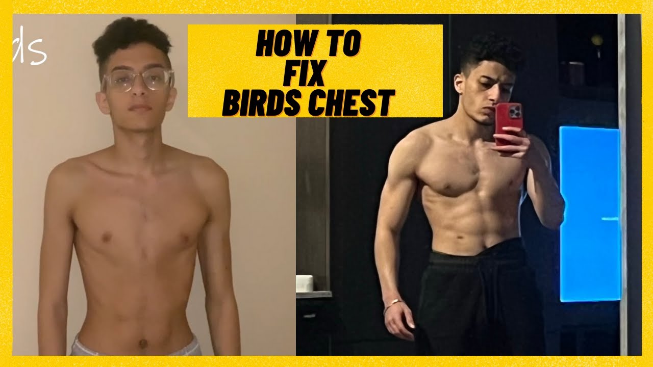 HOW I FIXED MY BIRDS CHEST - Transform Your Chest Fast