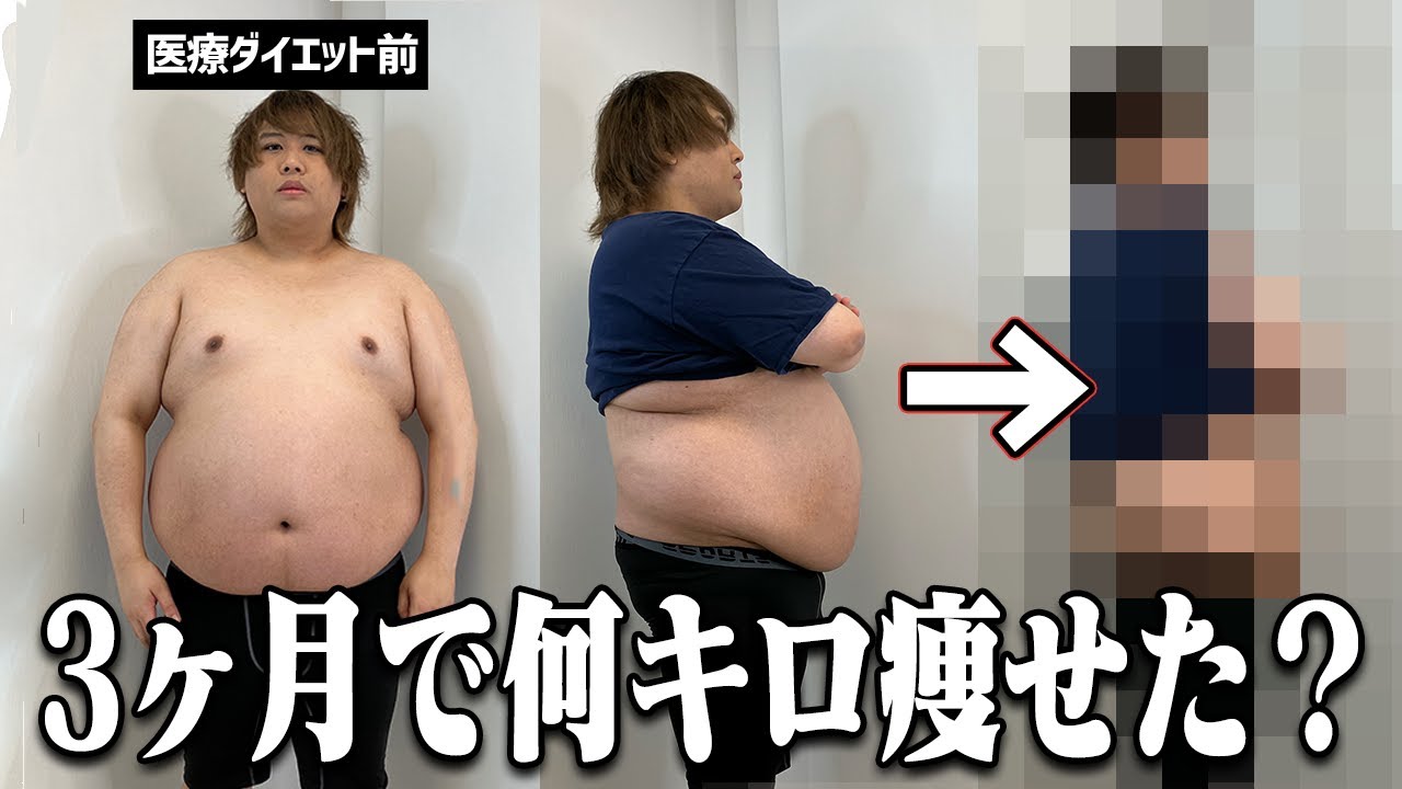 【衝撃】132kgまでリバウンドしたけど、めちゃくちゃ楽に痩せることができました。