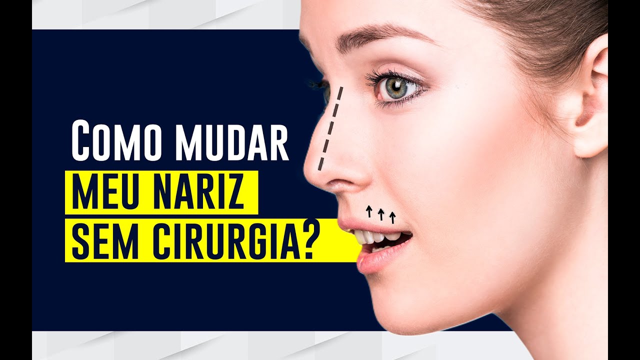Como MUDAR meu NARIZ SEM CIRURGIA? | Dr Vitor Erlacher