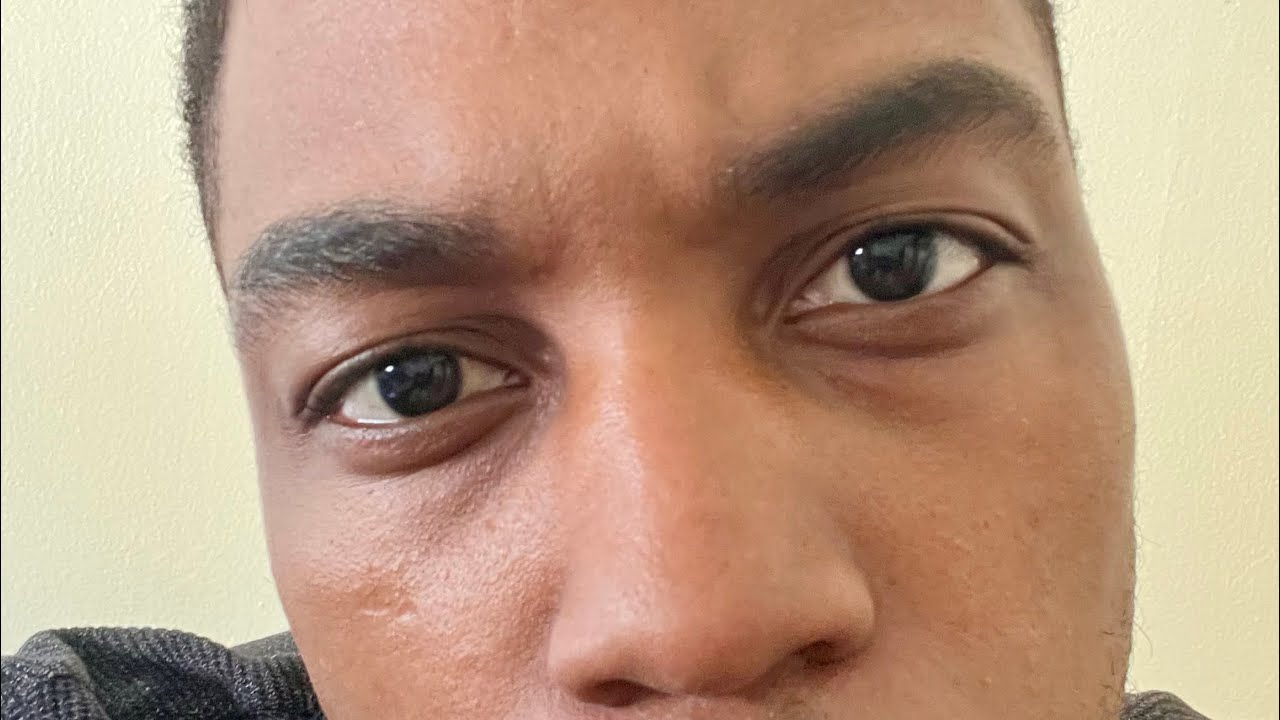 You Have Something In Your Eye 👁️Let Me Get It Out 🧽 (ASMR)