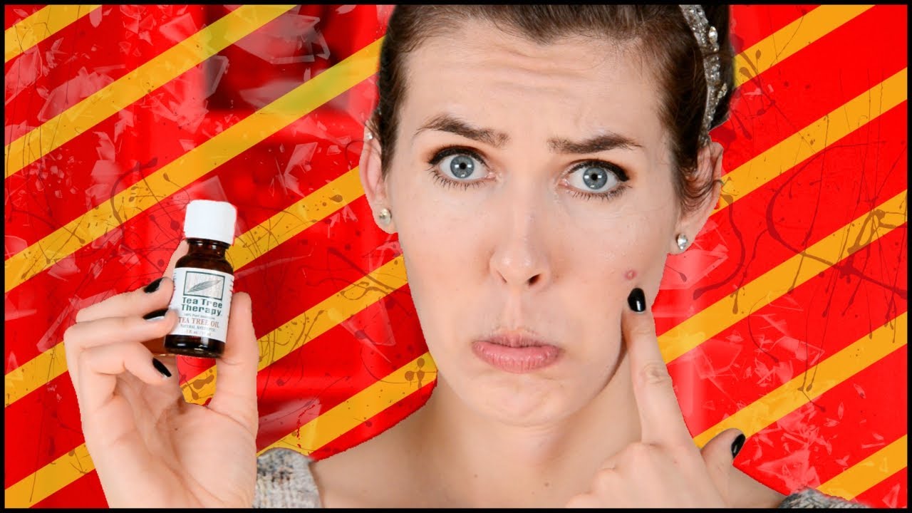 Tea Tree Oil For Acne!