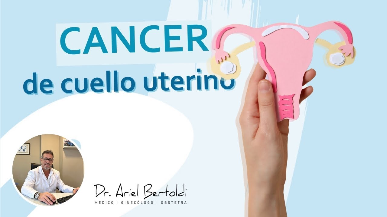 Cáncer de Cuello Uterino: Lo que TODA Mujer Debe Saber para Prevenirlo