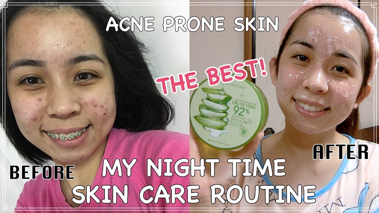 MY NIGHT TIME SKINCARE ROUTINE (ACNE PRONE SKIN)  ( TAGALOG )  - MoniqueTakeda 🌸