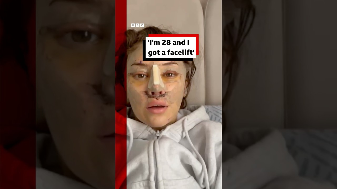 &bdquo;Mam 28 lat i poddałam się liftingowi twarzy&rdquo;. #Lifting twarzy #Chirurgiaplastyczna #BBCNews