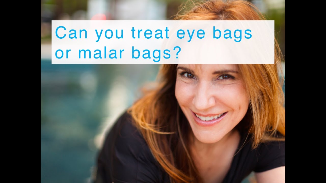 Can you treat eye bags or malar bags?