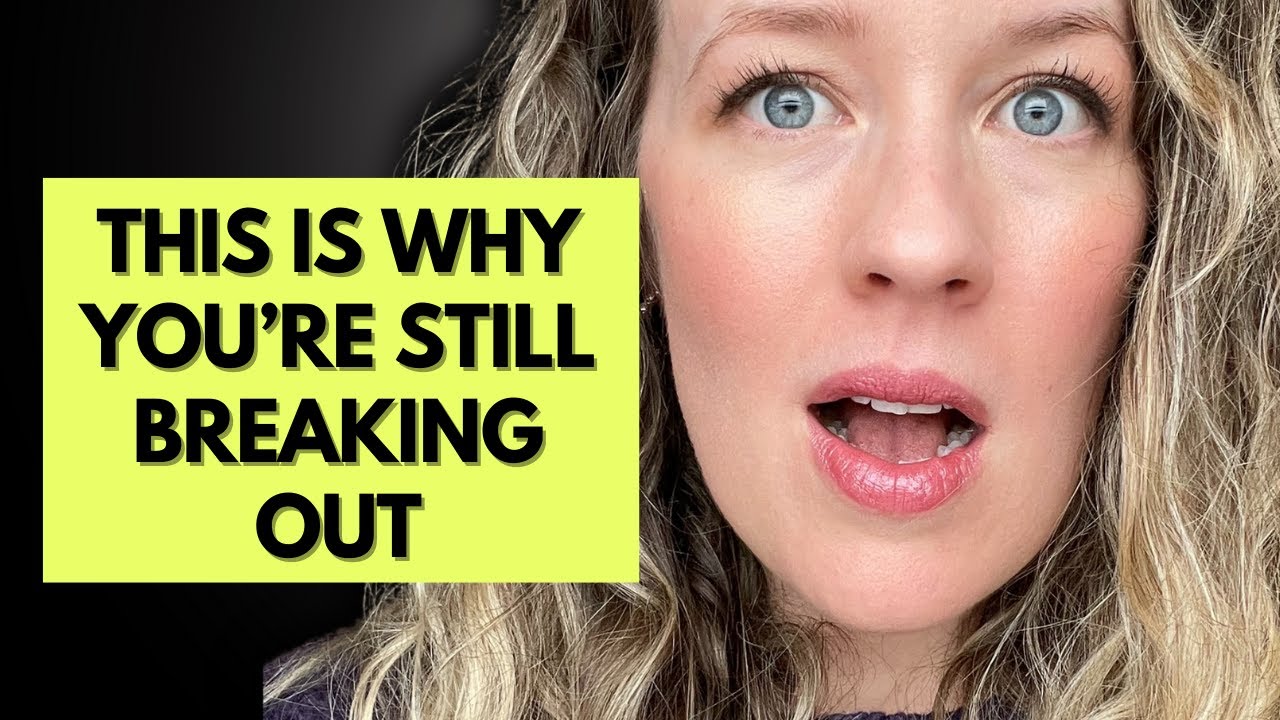 Jawline acne - THIS is why you can't clear it naturally