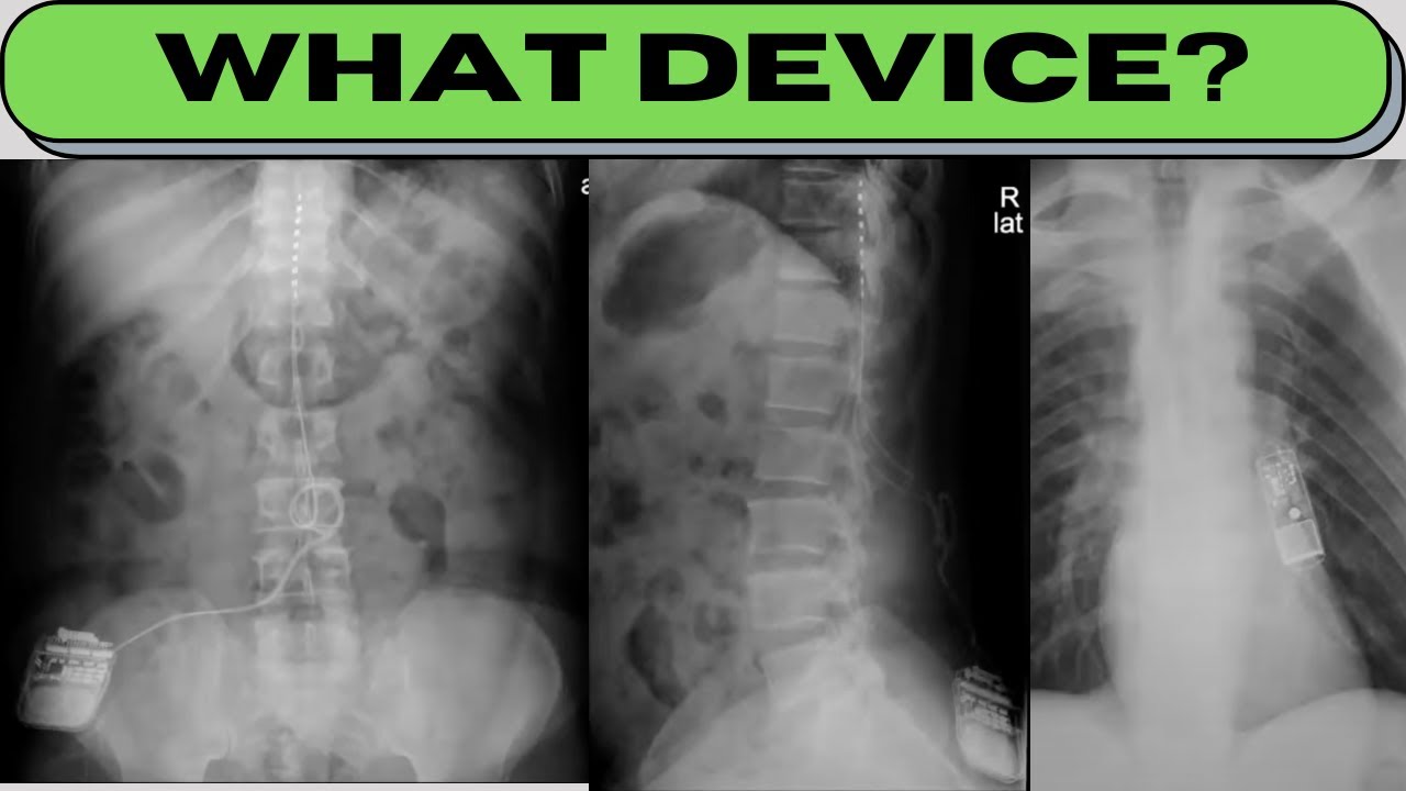 High Yield Radiology Exam Cases | Dr. Sabahat Ather