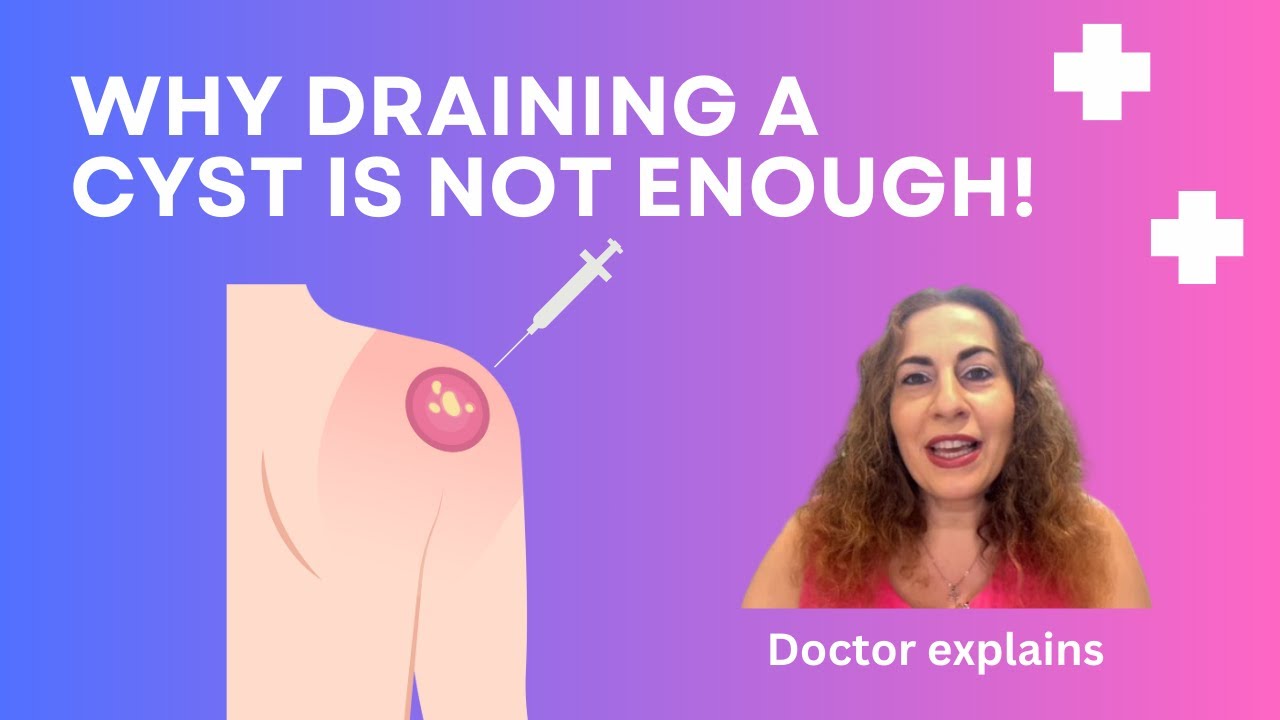 Why Draining a Cyst Won't Cure It - Doctor's Explanation