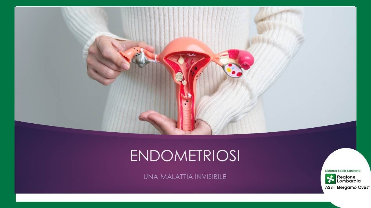 ENDOMETRIOSI - UNA MALATTIA INVISIBILE