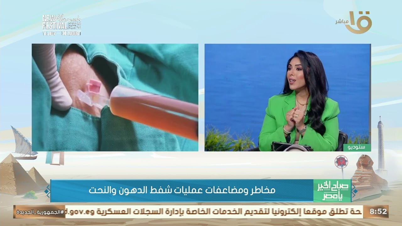 مخاطر ومضاعفات عمليات شفط الدهون والنحت.. يوضحها د. أسامة الشحات أستاذ جراحة التجميل بطب الأزهر