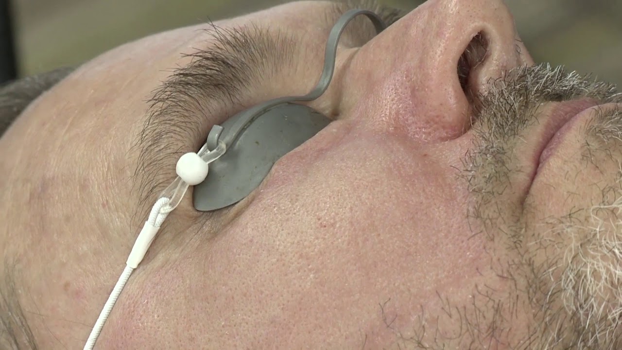 Fractional Skin Resurfacing with Ellipse Frax 1550: Part 5