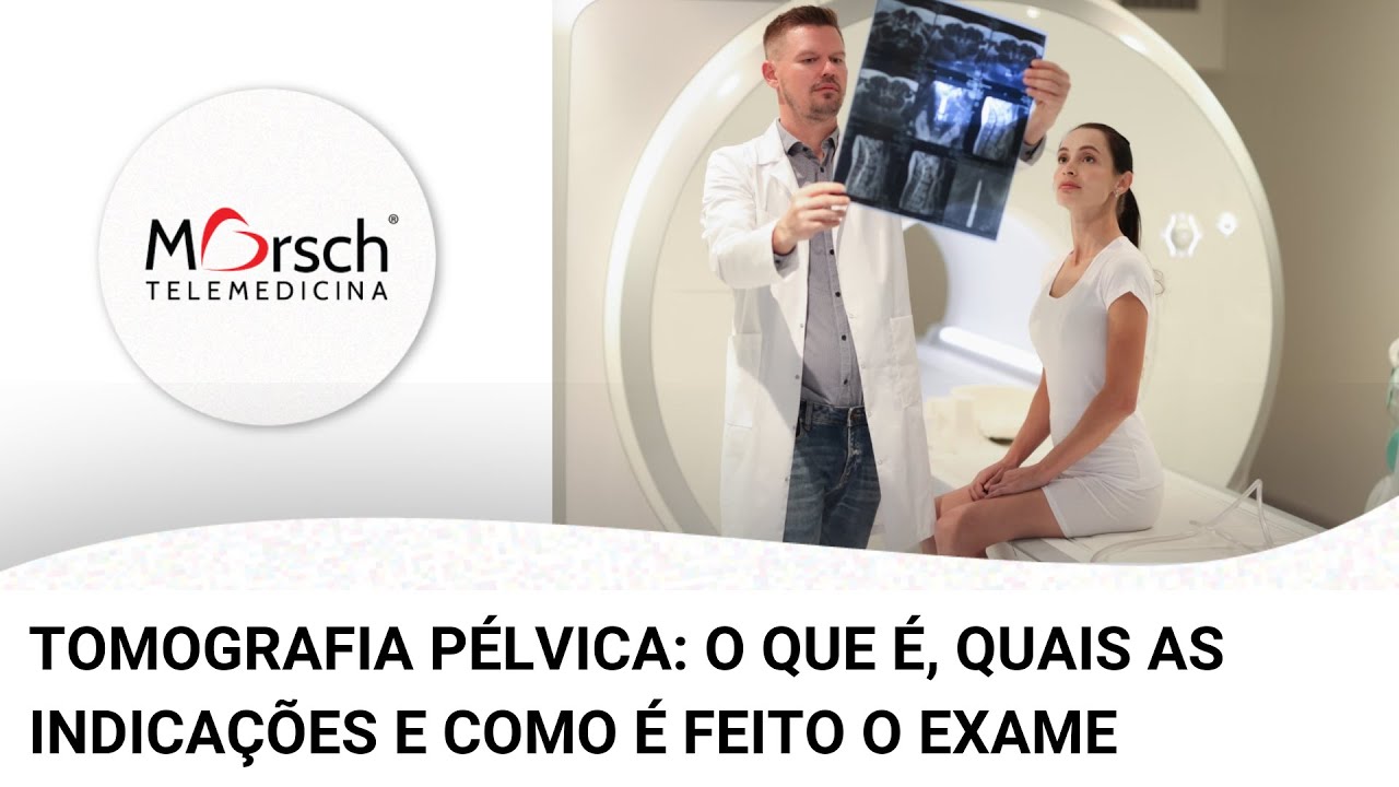 TOMOGRAFIA PÉLVICA: O QUE É, QUAIS AS INDICAÇÕES E COMO É FEITO O EXAME