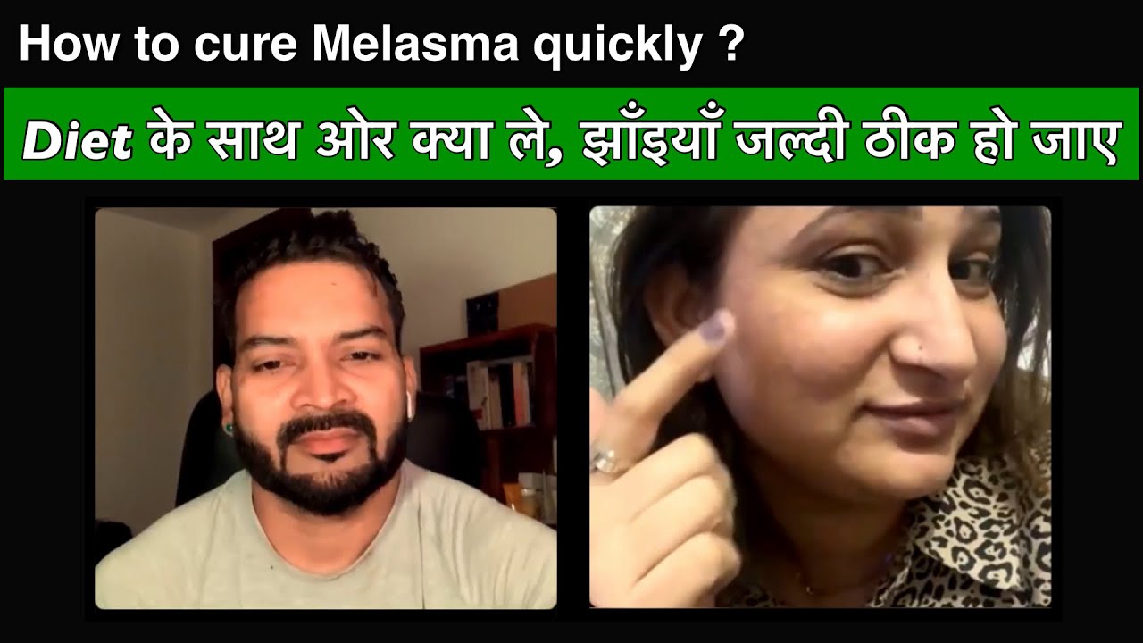 Diet के साथ ओर क्या ले, झाँइयाँ जल्दी ठीक हो जाए ?