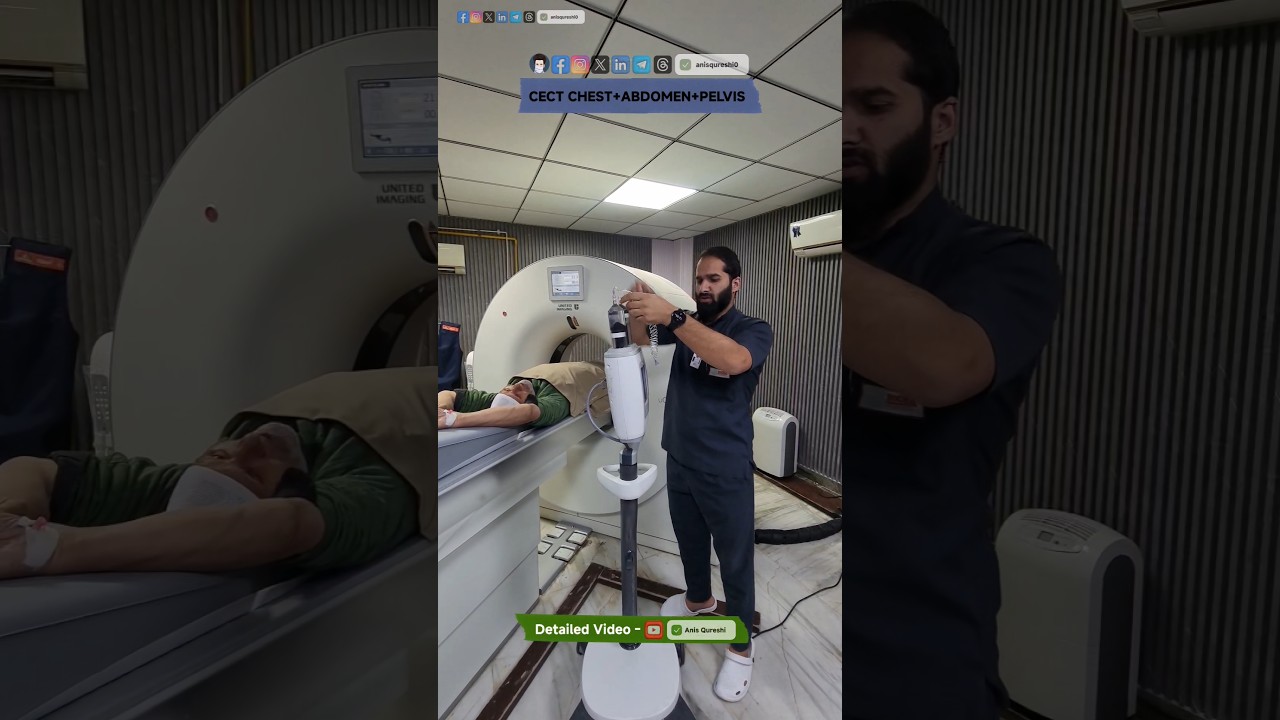 Cect Chest + Abdomen +Pelvis  | By Anis Qureshi #radiology #medical #science #learningradiology
