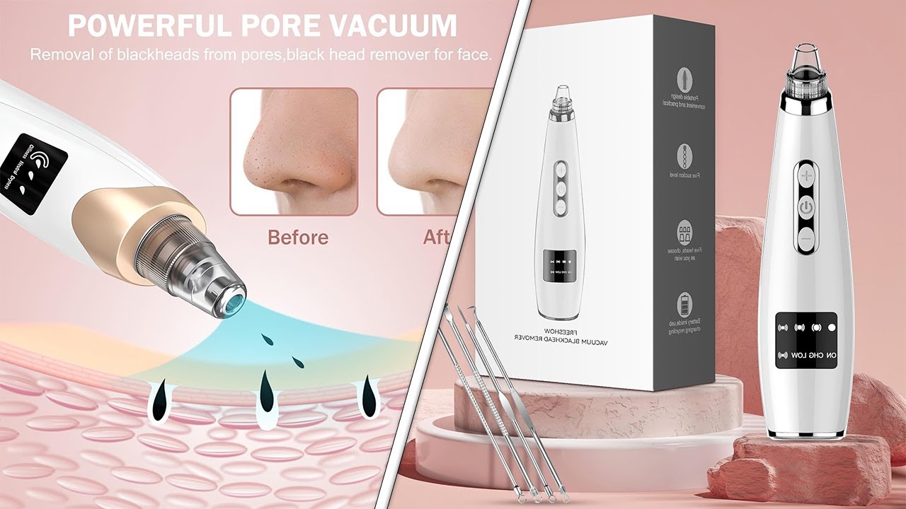Top 5 Best Pore Vacuums of 2025