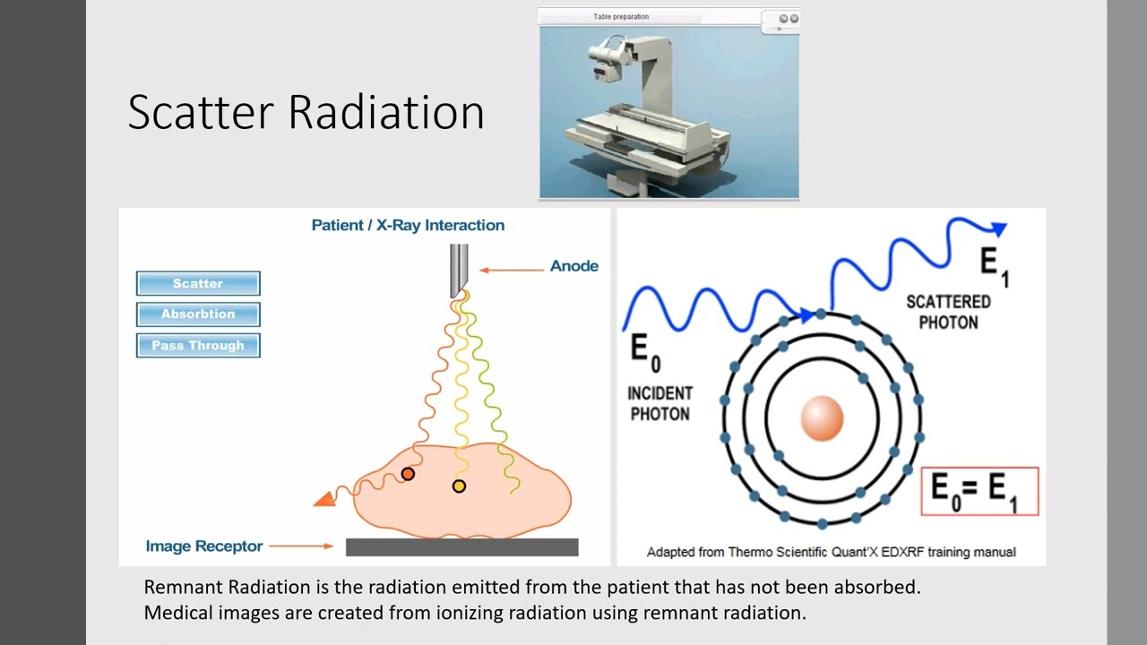 X-ray Low Dose Digital Imaging