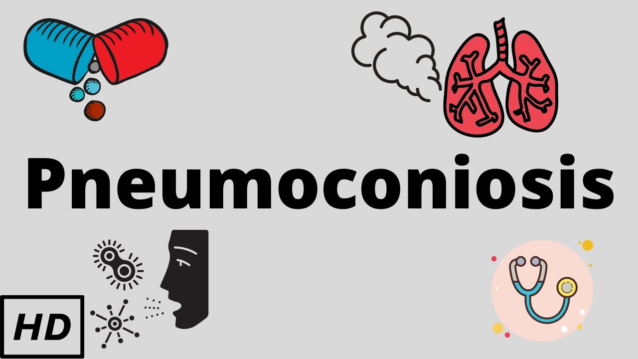 Pneumoconiosis, Causes, Signs and Symptoms, Diagnosis and Treatment.