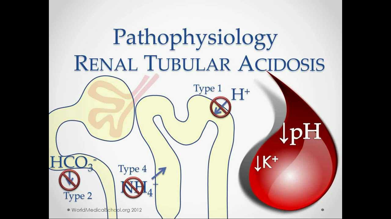 Renal Tubular Acidosis - USMLE STep 2 Review