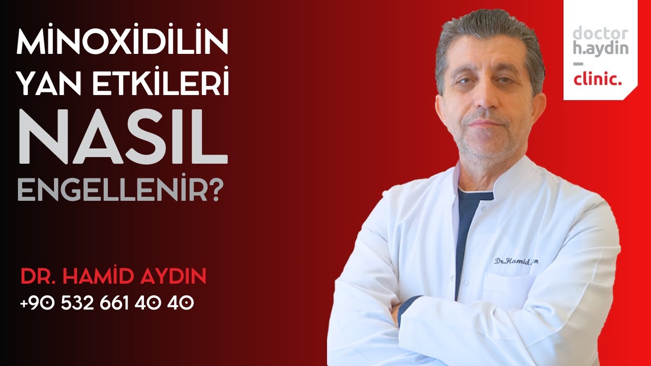 Minoxidilin Yan Etkileri Nasıl Engellenir? - Dr. Hamid AYDIN