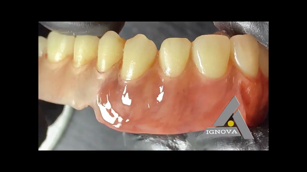 Encías naturales técnica de maquillaje MG-CRYL , recuerda que capacitarse es un crecimiento para ti