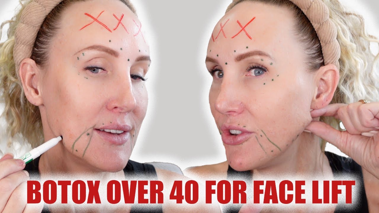 Should Your Botox Change as You Age? Botox Face Lifting Over 40