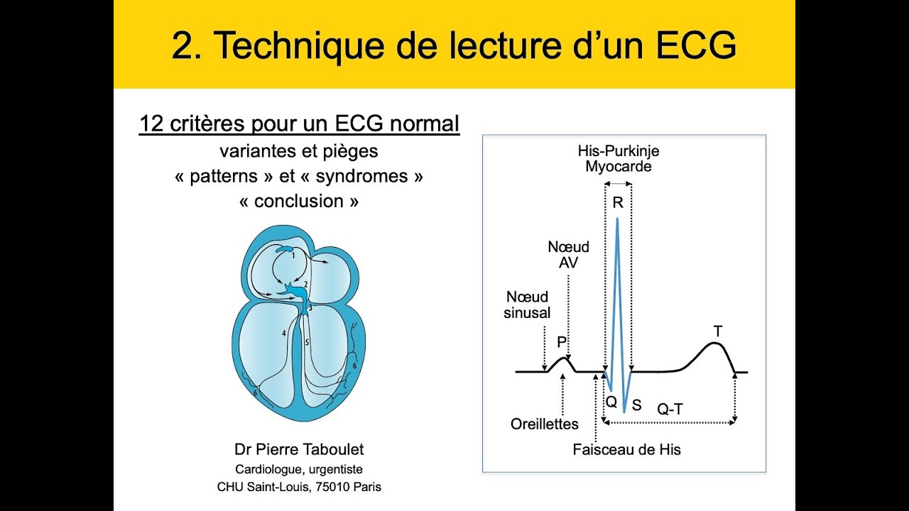 Cours 2. ECG Technique de lecture. Les 12 critères d'un ECG normal. Dr Taboulet