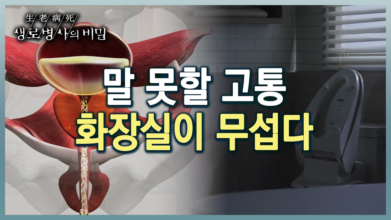 화장실만 들락날락... 전립선 비대증의 원인과 치료 방법 (KBS 20230215 방송)