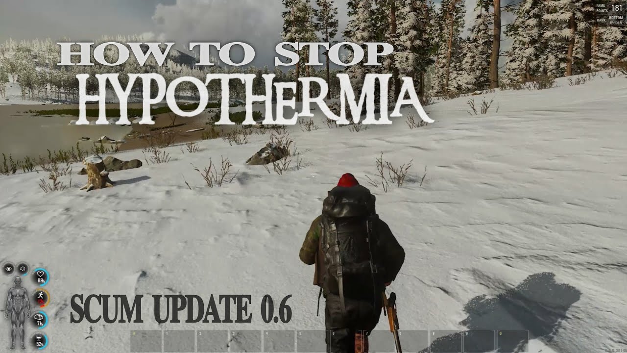 Scum guide - easiest way to stop Hypothermia