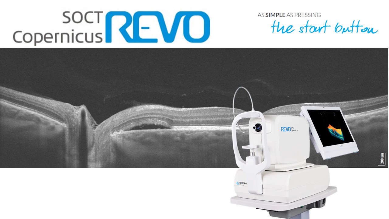 System Vision  : REVO SD-OCT & Angio Presentation
