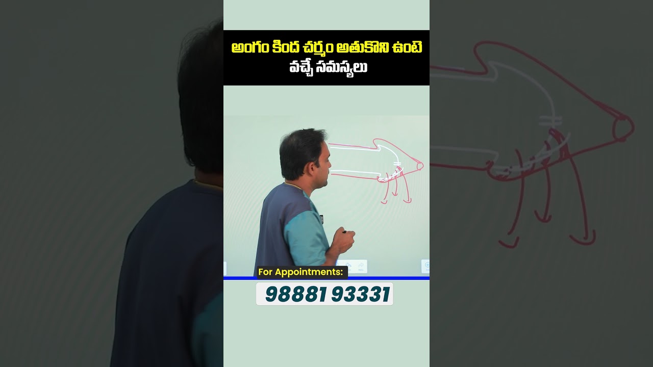 How to Fix Tight Frenulum? || Treatment Range Hospital || #shorts #ytshorts #frenulum #healthtips