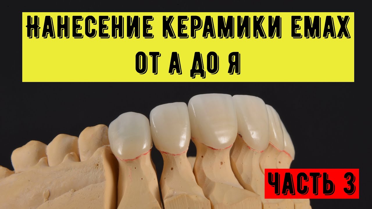 Нанесение керамики emax  на диоксид циркония каркас  Нанесение из 6 масс