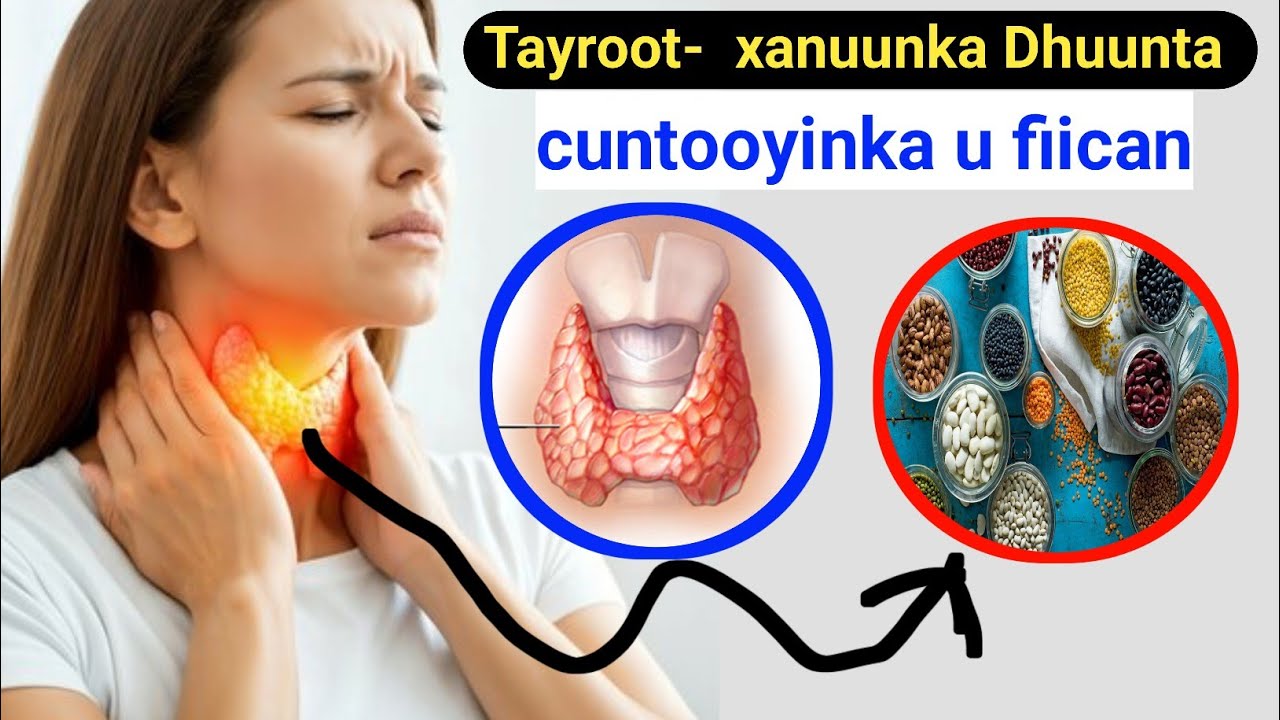 Cuntooyinka u fiican Tayroot-ka ( xanuunka Dhuunta ) iyo kuwa Halista ah kala Baro