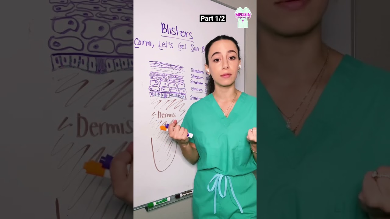 🔥 HOT TOPIC: How do blisters form? #medisin #medicine #blister #medisinstyle #dermatology