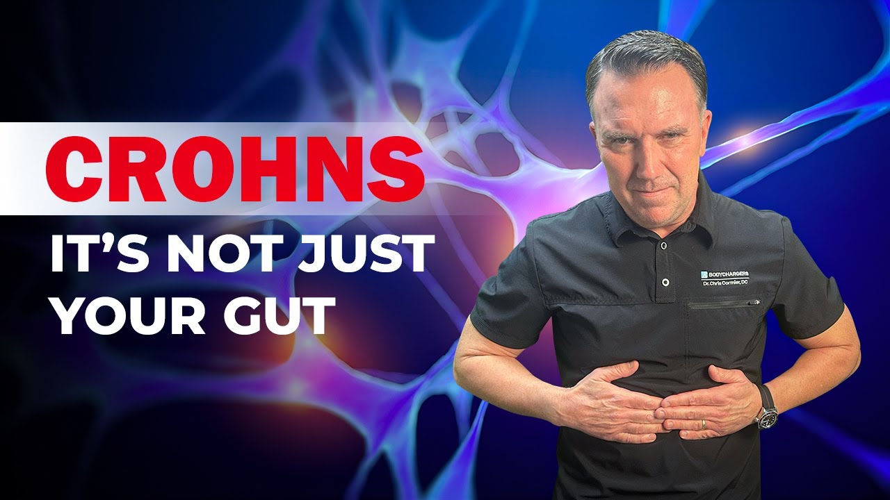 Crohn’s Disease Explained: Why It’s Not Just a Gut Problem